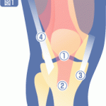 膝の慢性障害