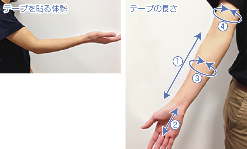 肘の過伸展を制限するためのテーピング Cramerjapan