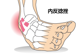 ãåè¿ãæ»æ«ãã®ç»åæ¤ç´¢çµæ